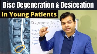 Disc Degeneration L5 S1 Disc Desiccation Disc Degeneration Causes DDDDegenerative Disc Treatment [upl. by Sheply]