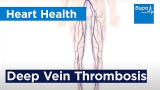 How deep vein thrombosis DVT forms  Bupa Health [upl. by Kries]