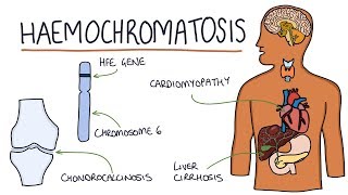 Understanding Haemochromatosis [upl. by Solokin]