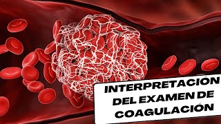 Interpretación de Pruebas de coagulación [upl. by Nuris]