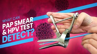 Pap Smear Pap Test and HPV Test  A step by step guide 3D at what happens during the test [upl. by Nevetse676]