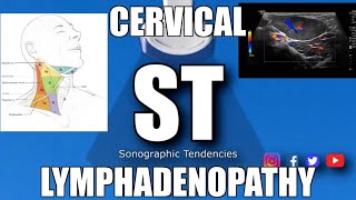 Sonoquickies  Cervical Lymphadenopathy [upl. by Liddie134]