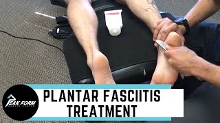 Plantar Fasciitis Treatment San Diego Graston Chiropractic [upl. by Bust]