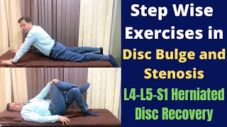 Exercises For Herniated Disc Disc Bulge L4L5S1 Step Wise Treatment for Slipped Disc Recovery [upl. by Girhiny]