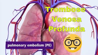 Trombose Venosa Profunda TVP e Embolia Pulmonar EP [upl. by Laurette]