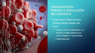 HEMOSTASIA y COAGULACIÓN SANGUÍNEA  GUYTON FISIOLOGÍA [upl. by Nabetse429]