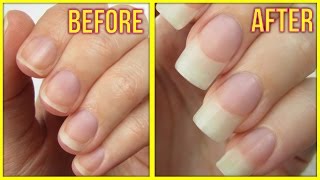 5 Ways to Grow Your Nails FAST [upl. by Htenaj112]