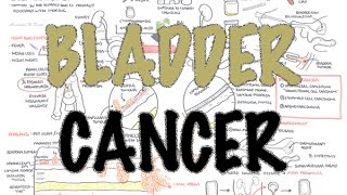 Throat Cancer Symptoms  Cancer Research UK [upl. by Raffin]