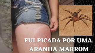 PICADA DE ARANHA MARROM 🕷 [upl. by Riocard]