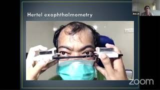 How to perform opthalmoscope exam [upl. by Dirtsa]