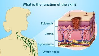 Understanding Melanoma [upl. by Nylave282]