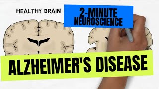 We Might Be Totally Wrong About Alzheimer’s [upl. by Ayhdiv]