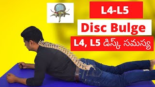 L4L5 Disc Bulge exercises  Sciatica relief herniated disc exercises L4L5 [upl. by Tench]