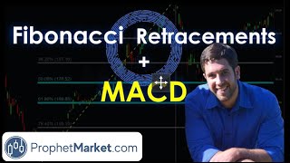 Fibonacci Retracement Strategy AMAZING way to trade with the MACD [upl. by Swayne221]