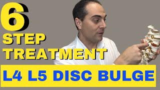 6 Step L4 L5 Disc Bulge Treatment L4 L5 Bulging Disc Treatment by Dr Walter Salubro [upl. by Adnahcal]