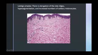 Benign pigmented and melanocytic lesions [upl. by Bettina626]