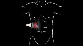 Complete IVP ProcedureIVU [upl. by Banky]