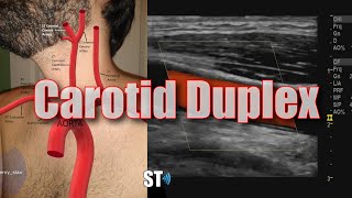 Carotid Duplex Exam [upl. by Alana]