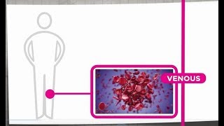 Venous Thrombosis Explained [upl. by Sacram645]