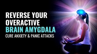 Reverse Your Overactive Brain Amygdala  Lessen Fear Response in Body  Cure Anxiety amp Panic Attacks [upl. by Aniaj677]