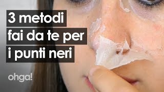 Come togliere i punti neri con 3 rimedi naturali ed efficaci fai da te [upl. by Nylra]