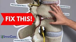 How to Fix a Bulging Disc in Your Lower Back  RELIEF IN SECONDS [upl. by Stace214]