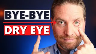 How To Get Rid Of Dry Eyes  4 Advanced Home Treatments [upl. by Wanfried]