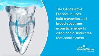 Demonstrating the GentleWave® Technology [upl. by Ladin]