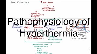 Hyperthermia Pathophysiology [upl. by Llerryt]