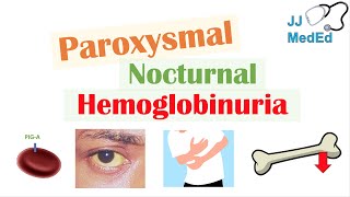 Paroxysmal Nocturnal Hemoglobinuria PNH  Causes amp Pathogenesis Symptoms Diagnosis amp Treatment [upl. by Ynnus636]