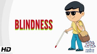 Blindness Causes Signs and Symptoms Diagnosis and Treatment [upl. by Joey]