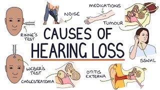 Symptoms of Hearing Damage from Loud Noise [upl. by Oemac]