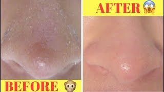 DIY Natural Skincare Routine  Oily amp Dry Skin [upl. by Ejrog]