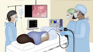 Upper GI Endoscopy Procedure in the ED [upl. by Prissie]