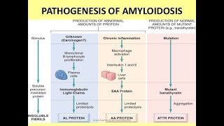 What is AL amyloidosis [upl. by Irina588]