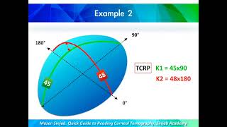 A Quick Guide to Reading Corneal Tomography Part 5 [upl. by Skipton684]