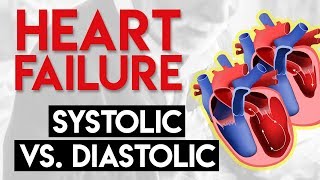 Systolic vs Diastolic Heart Failure  Heart Failure Part 2 [upl. by Haase]