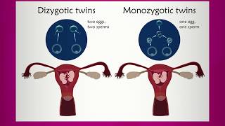 Learning about Multiple Pregnancy [upl. by Lapo]