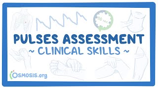 Clinical Skills Pulses assessment [upl. by Eeneg]