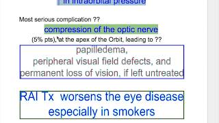 Exophthalmos Thyroid Ophthalmopathy [upl. by Nnaeilsel750]