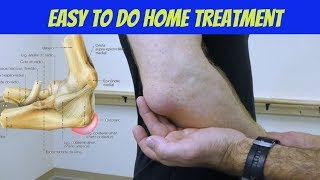 Hip Bursitis Treatment Drug free amp NonInvasive [upl. by Danit]