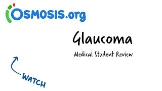 Glaucoma  Clinical Presentation [upl. by Edrahc534]