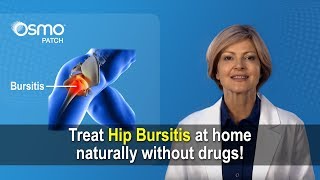 Knee Bursitis  Everything You Need To Know  Dr Nabil Ebraheim [upl. by Lauber]