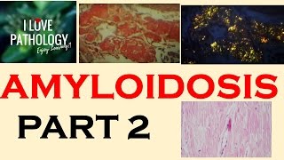 AMYLOIDOSIS Part 1 Definition Historical aspects amp Properties of Amyloid [upl. by Richmond480]