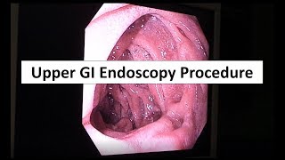 Your Childs Endoscopy What to Expect [upl. by Knowland]