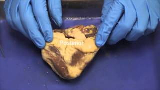 NAU BIo 202 Lab 3  Sheep Heart Dissection [upl. by Hinkel185]